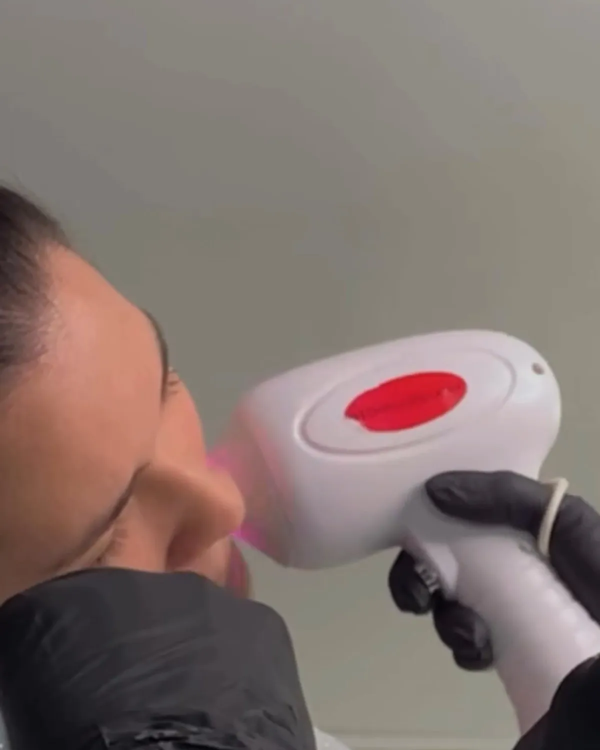 Depilación láser facial en Salon Deluxe, Cumaná